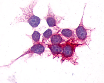 Immunocytochemistry - Anti-P2Y14 antibody (AB140896)