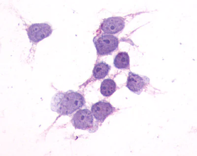 Immunocytochemistry - Anti-P2Y14 antibody (AB140896)