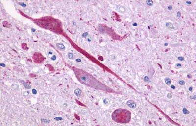 Immunohistochemistry (Formalin/PFA-fixed paraffin-embedded sections) - Anti-P2Y14 antibody (AB140896)