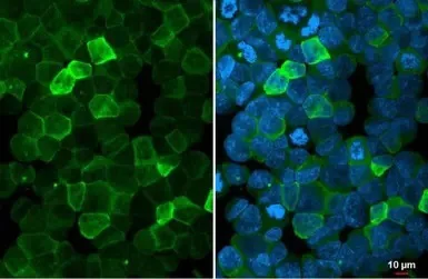 Immunocytochemistry/ Immunofluorescence - Anti-P2Y2 antibody (AB272891)