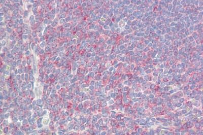 Immunohistochemistry (Formalin/PFA-fixed paraffin-embedded sections) - Anti-P311 antibody (AB167017)