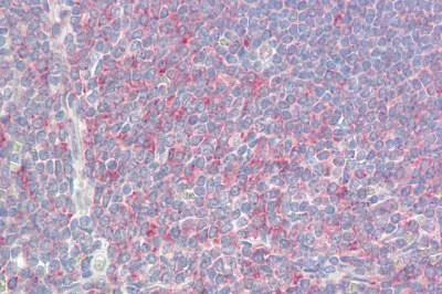 Immunohistochemistry (Formalin/PFA-fixed paraffin-embedded sections) - Anti-P311 antibody (AB167017)