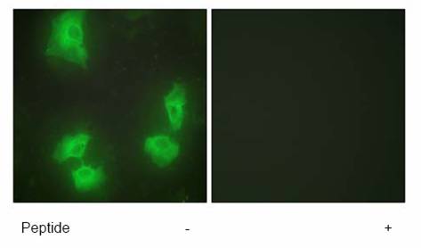 Immunocytochemistry/ Immunofluorescence - Anti-p35 antibody (AB64960)