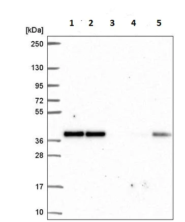 Western blot - Anti-p37 antibody (AB220675)