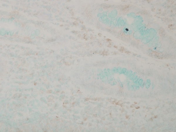 Immunohistochemistry (Formalin/PFA-fixed paraffin-embedded sections) - Anti-p38 alpha/MAPK14 antibody [9F12] (AB59461)