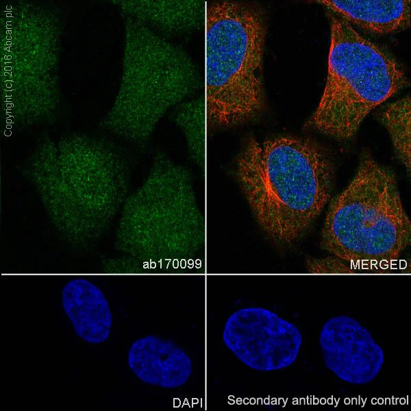 Immunocytochemistry/ Immunofluorescence - Anti-p38 alpha/MAPK14 antibody [E229] (AB170099)