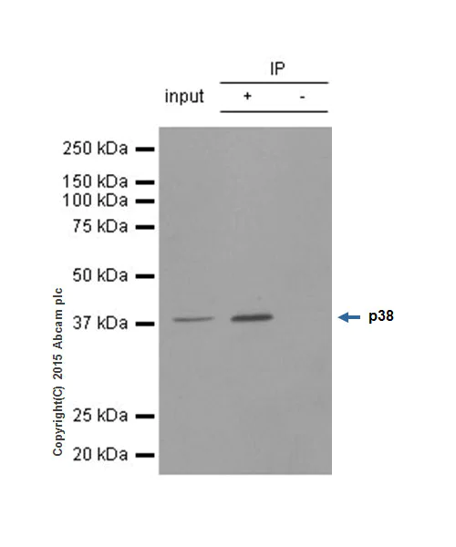 Immunoprecipitation - Anti-p38 alpha/MAPK14 antibody [E229] (AB170099)