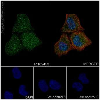 Immunocytochemistry/ Immunofluorescence - Anti-p38 alpha/MAPK14 antibody [EPR16878] (AB182453)