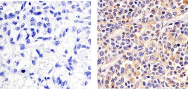 Immunohistochemistry paraffin embedded sections - Anti-p38 alpha/MAPK14 (phospho T180 + Y182) antibody [RP23040012] (AB308038)