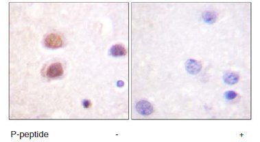 Immunohistochemistry (Formalin/PFA-fixed paraffin-embedded sections) - Anti-p38 alpha/MAPK14 (phospho Y322) antibody (AB60999)