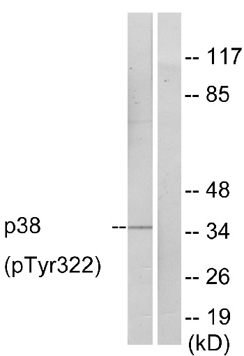 Western blot - Anti-p38 alpha/MAPK14 (phospho Y322) antibody (AB60999)