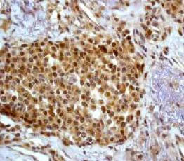 Immunohistochemistry (Formalin/PFA-fixed paraffin-embedded sections) - Anti-p38 beta/MAPK11 + p38 alpha/MAPK14 antibody [Y122] - BSA and Azide free (AB227995)