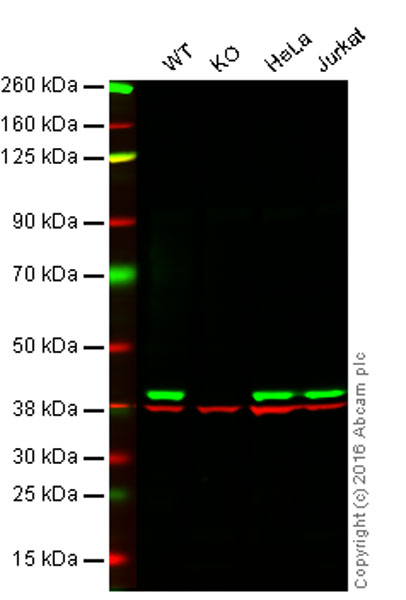 Western blot - Anti-p38 delta/MAPK13 + p38 alpha/MAPK14 antibody [M138] (AB31828), expandable thumbnail