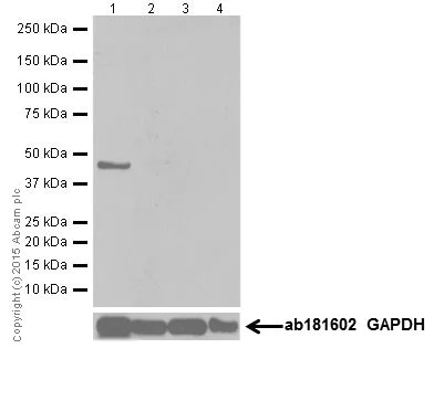Western blot - Anti-p38 gamma/MAPK12 antibody [EPR6528(N)] - BSA and Azide free (AB251440)