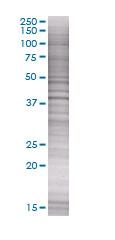p38 overexpression 293T lysate (whole cell)