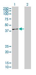 Western blot - p38 overexpression 293T lysate (whole cell) (AB94056)