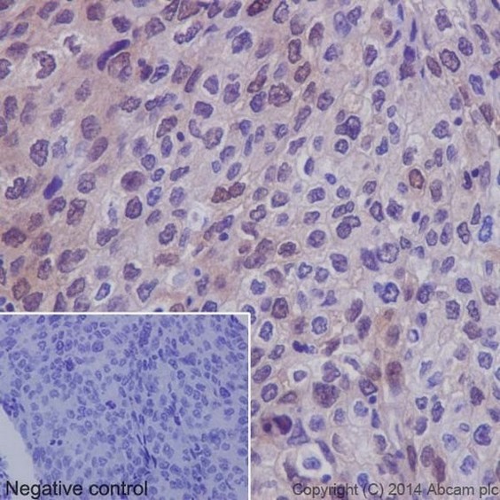 Immunohistochemistry (Formalin/PFA-fixed paraffin-embedded sections) - Anti-p38 (phospho T180) antibody [EPR16587] (AB178867), expandable thumbnail
