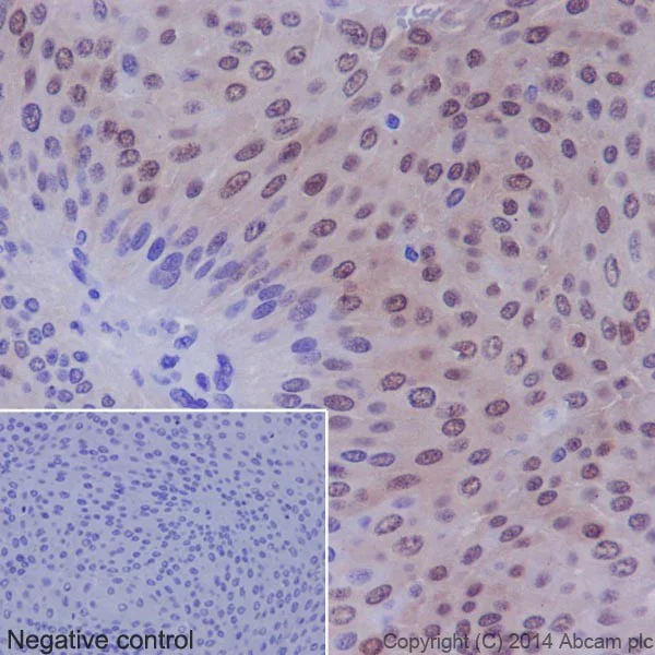 Immunohistochemistry (Formalin/PFA-fixed paraffin-embedded sections) - Anti-p38 (phospho T180) antibody [EPR16587] (AB178867)