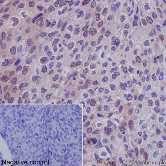Immunohistochemistry (Formalin/PFA-fixed paraffin-embedded sections) - Anti-p38 (phospho T180) antibody [EPR16587] - BSA and Azide free (AB236527)