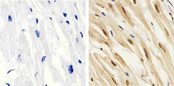 Immunohistochemistry (Formalin/PFA-fixed paraffin-embedded sections) - Anti-p38 (phospho T180 + Y182) antibody (AB4822)