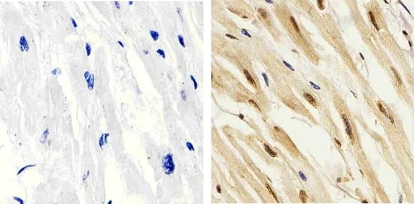 Immunohistochemistry (Formalin/PFA-fixed paraffin-embedded sections) - Anti-p38 (phospho T180 + Y182) antibody (AB4822)