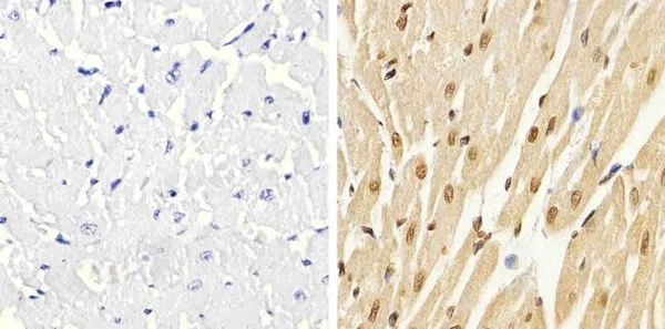Immunohistochemistry (Formalin/PFA-fixed paraffin-embedded sections) - Anti-p38 (phospho T180 + Y182) antibody (AB4822)