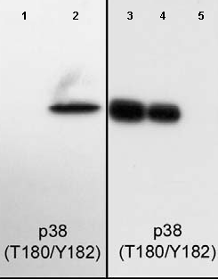 Western blot - Anti-p38 (phospho T180 + Y182) antibody [M139] (AB45381), expandable thumbnail