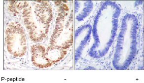 Immunohistochemistry (Formalin/PFA-fixed paraffin-embedded sections) - Anti-p38 (phospho Y182) antibody (AB47363)
