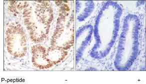 Immunohistochemistry (Formalin/PFA-fixed paraffin-embedded sections) - Anti-p38 (phospho Y182) antibody (AB47363)
