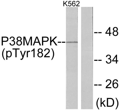 Western blot - Anti-p38 (phospho Y182) antibody (AB47363)