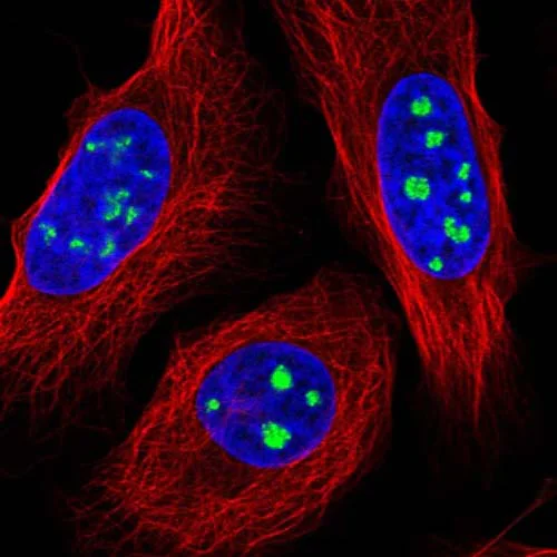 Immunocytochemistry/ Immunofluorescence - Anti-p38IP antibody (AB122517)