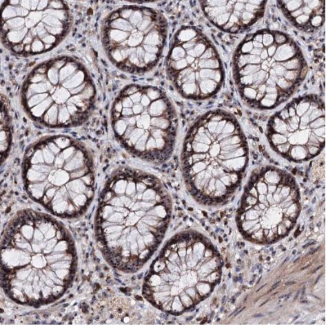 Immunohistochemistry (Formalin/PFA-fixed paraffin-embedded sections) - Anti-p38IP antibody (ab122517), expandable thumbnail