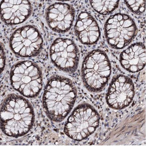 Immunohistochemistry (Formalin/PFA-fixed paraffin-embedded sections) - Anti-p38IP antibody (AB122517)