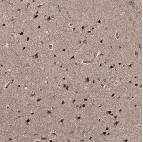 Immunohistochemistry (Formalin/PFA-fixed paraffin-embedded sections) - Anti-p38IP antibody (AB122517), expandable thumbnail