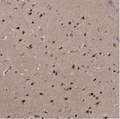 Immunohistochemistry (Formalin/PFA-fixed paraffin-embedded sections) - Anti-p38IP antibody (AB122517)