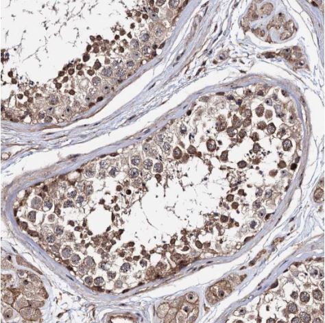 Immunohistochemistry (Formalin/PFA-fixed paraffin-embedded sections) - Anti-p38IP antibody (AB122517), expandable thumbnail