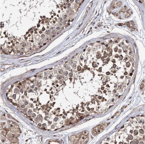 Immunohistochemistry (Formalin/PFA-fixed paraffin-embedded sections) - Anti-p38IP antibody (AB122517)