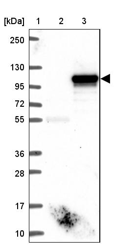 Western blot - Anti-p38IP antibody (AB122517), expandable thumbnail