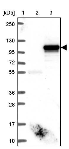 Western blot - Anti-p38IP antibody (AB122517)