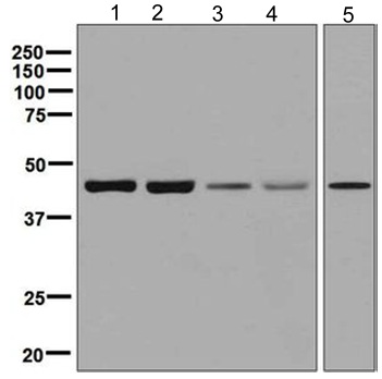 Western blot - Anti-p39 antibody [EPR5075(2)] (AB129196)