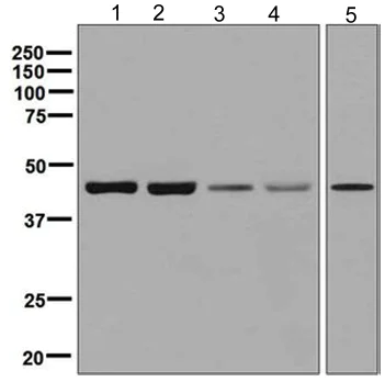Western blot - Anti-p39 antibody [EPR5075(2)] (AB129196)