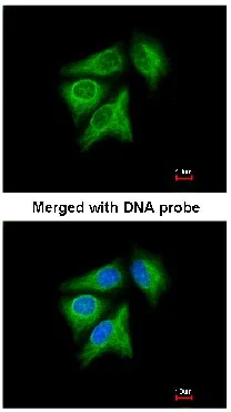 Immunocytochemistry/ Immunofluorescence - Anti-p40 antibody (AB137691)