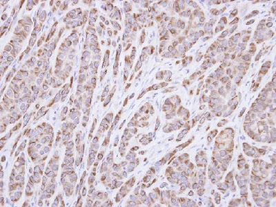 Immunohistochemistry (Formalin/PFA-fixed paraffin-embedded sections) - Anti-p40 antibody (AB137691)