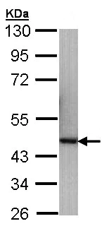 Western blot - Anti-p40 antibody (AB137691)