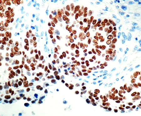 Immunohistochemistry (Formalin/PFA-fixed paraffin-embedded sections) - Anti-p40 - DeltaNp63 antibody (AB166857)