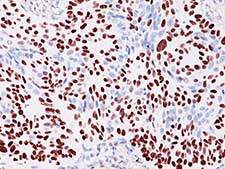 Immunohistochemistry (Formalin/PFA-fixed paraffin-embedded sections) - Anti-p40 - DeltaNp63 antibody (AB167612), expandable thumbnail