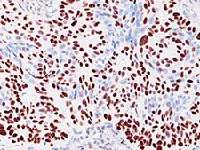 Immunohistochemistry (Formalin/PFA-fixed paraffin-embedded sections) - Anti-p40 - DeltaNp63 antibody (AB167612)
