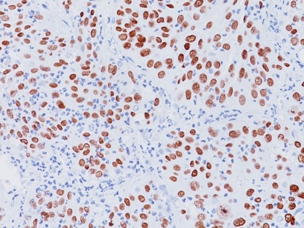 Immunohistochemistry (Formalin/PFA-fixed paraffin-embedded sections) - Anti-p40 - DeltaNp63 antibody [BC28] (AB172731)