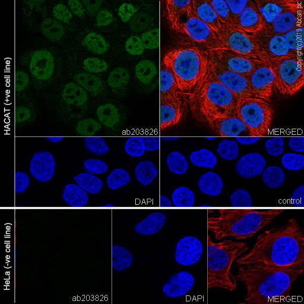 Immunocytochemistry/ Immunofluorescence - Anti-p40 - DeltaNp63 antibody [EPR17863-47] - BSA and Azide free (AB269956), expandable thumbnail