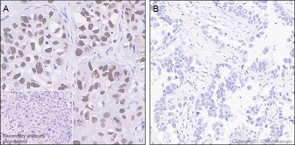 Immunohistochemistry (Formalin/PFA-fixed paraffin-embedded sections) - Anti-p40 - DeltaNp63 antibody [EPR17863-47] - BSA and Azide free (ab269956), expandable thumbnail